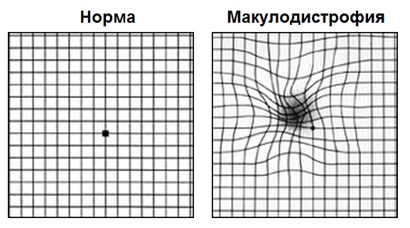 test-amslera-resultat.jpg test-amslera-resultat.jpg
